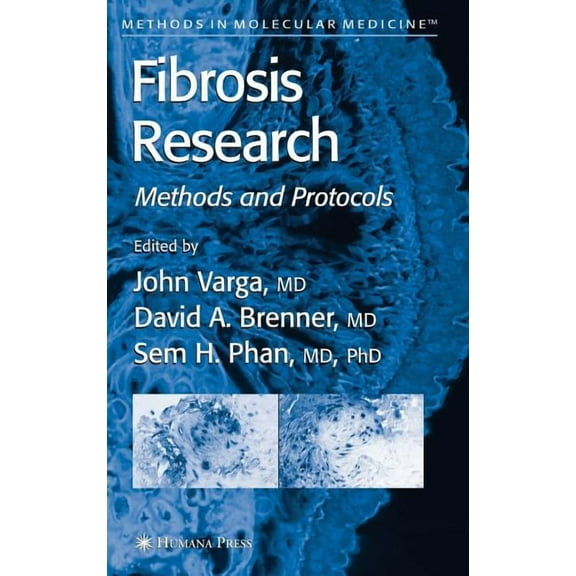 Methods in Molecular Medicine Fibrosis Research: Methods and Protocols, Book 117, (Hardcover)