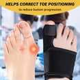 thumbnail image 2 of Effective Corrector for Women and Men | Relief Kit, Straighten Toes, and Correct Alignment | Cushion Sleeves | Feet Support -, 2 of 5