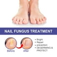 Nail Solution And Thicken Nails Soft Nail Polish Nail Care Solution For