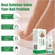 thumbnail image 2 of Suero para tratamiento de hongos en las uñas, productos de reparación de hongos en los dedos, Gel de eliminación para el cuidado de los pies y manos, antiinfección, onicomicosis, paroniquia, 2 of 5