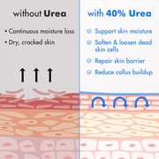 Ebanel Urea Cream 40% plus Salicylic Acid 2%, Foot Cream for Dry Cracked Heels Feet Knees Elbows Hands, Foot Dead Skin Cuticle Callus Remover Toenail Softener, Keratolytic Skin Barrier Repair