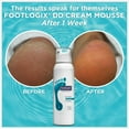 thumbnail image 4 of Crema Mousse FOOTLOGIX DD para piel seca e irritada 125 ml, 4 of 6