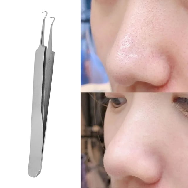 Herramienta para quitar espinillas, pinzas para espinillas, aguja curvada de acero inoxidable para espinillas para hombres y mujeres