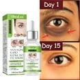 thumbnail image 2 of Ashosteey Anti Aging Eye Serum,Retinol Eye Serum,Bags Under Eyes, Instant Results Firm Eye Tightener Anti Aging Under Eye Cream for Men Women, Reduce Fine Lines Wrinkles and Age Spots, 2 of 9