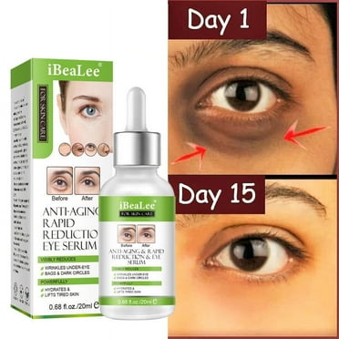 Aging Eye Serums For Women & Men - Eye Firming Serum, Eye Serum For Dark Circle And Puffiness, Dark Circle Under Eye Treatment For Woman, Reduces Puffiness, Dark Circles, Under Eye Bags