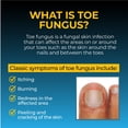 thumbnail image 4 of Pomada antifúngica Fungi-Nail mata hongos, 20 ml con tolnaftato, 4 of 7