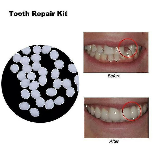 10g/100g diente y dentadura espacial pegamento sólido resina adhesivo para dentadura Dental dentista dentadura pegamento sólido temporal Kit de restauración de dientes Sincero Hogar