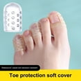 thumbnail image 2 of 10/30/50Pcs Silicone Toe Protector Set Breathable Gel Toe Covers for Corns Blisters Ingrown Toenails Pain Relief Little Toe Sleeves Caps Guards, 2 of 8