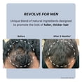 thumbnail image 4 of Actiiv Recover Thickening Shampoo Treatment for Men, 16 fl. oz., 4 of 4