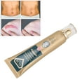 thumbnail image 3 of Scar Removal Cream, Scar Remover No Stimulation Safe Refreshing  For All Types Of Scars, 3 of 8