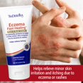 thumbnail image 2 of Crema para eccema TriDerma Fast Healing 180 ml para rostro y cuerpo, 2 of 8