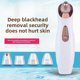 thumbnail image 1 of QUTETN Portable Pore - Cleansing Blackhead Remover for Home Use - The Ultimate Facial Cleansing Device to Remove Blackheads and Beautify Skin, 1 of 4