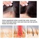 thumbnail image 4 of Ginger Hair Dense Hair Essence Strong Repair Growth Liquid Hair Care Hair Root Care Spray, 4 of 4