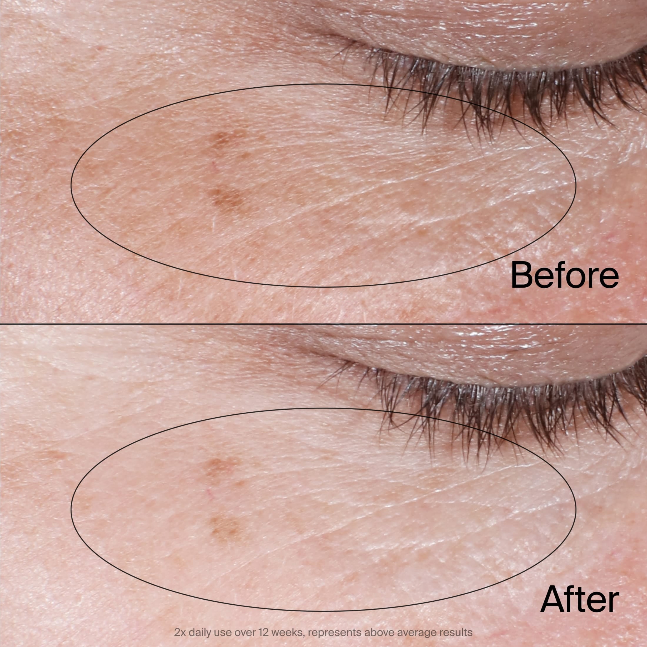 Neutrogena Collagen Bank Eye Gel Cream with Peptides 0.5 oz