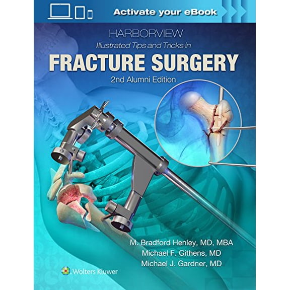 Pre-Owned Harborview Illustrated Tips and Tricks in Fracture Surgery, 9781496355980, 1496355989, Hardcover, 2 edition