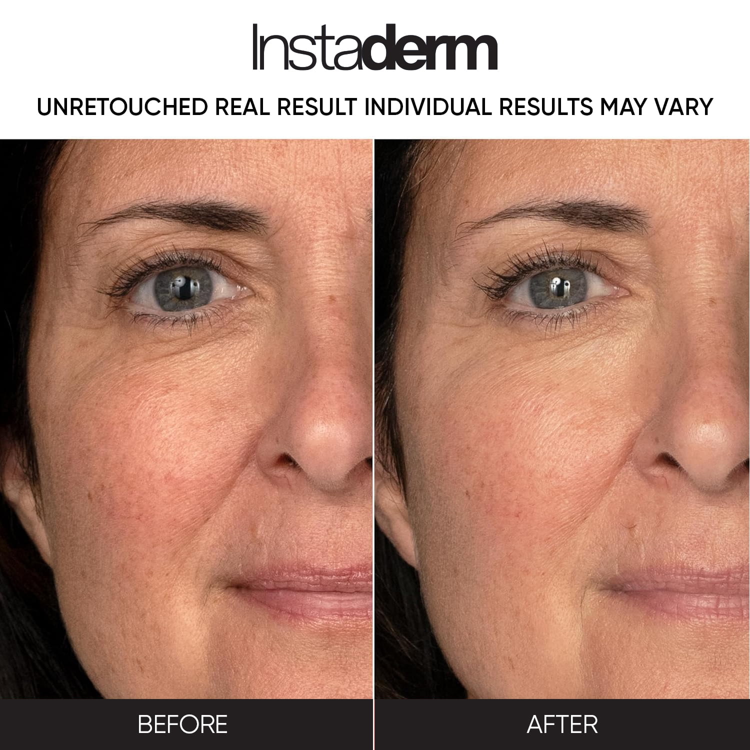 Retinol Skin Booster Cream- Age-Defying formula That Visibly Reduce The appearance of Fine Lines & Wrinkles. Improve Firmness, Elasticity, Thickness Of The Skin & Evens skin Tone.