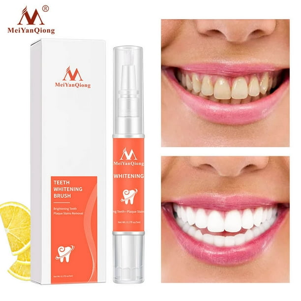 Lápiz blanqueador de dientes en gel, elimina rápidamente las manchas amarillas. Lápiz blanqueador de dientes de 5 ml. Crema.