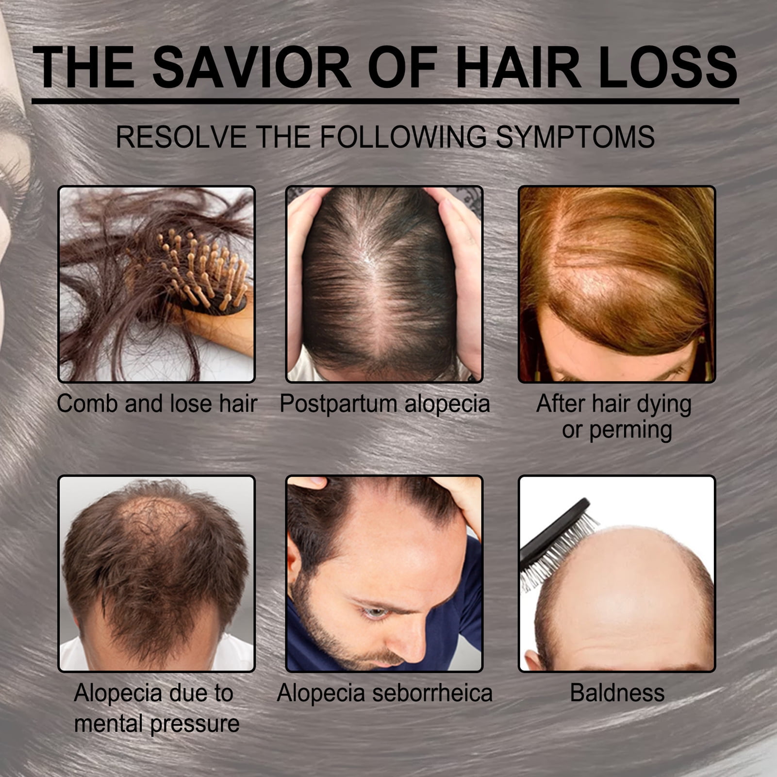 EELHOE 30ml Rosemary Hair Growth Essential Oil Hair Loss Nourish Scalp  Strengthen Hair 
