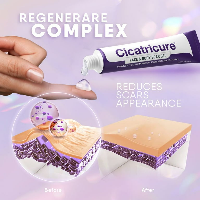 Cicatricure Scar Reducing Cream, Facial Fade Treatment, Scar