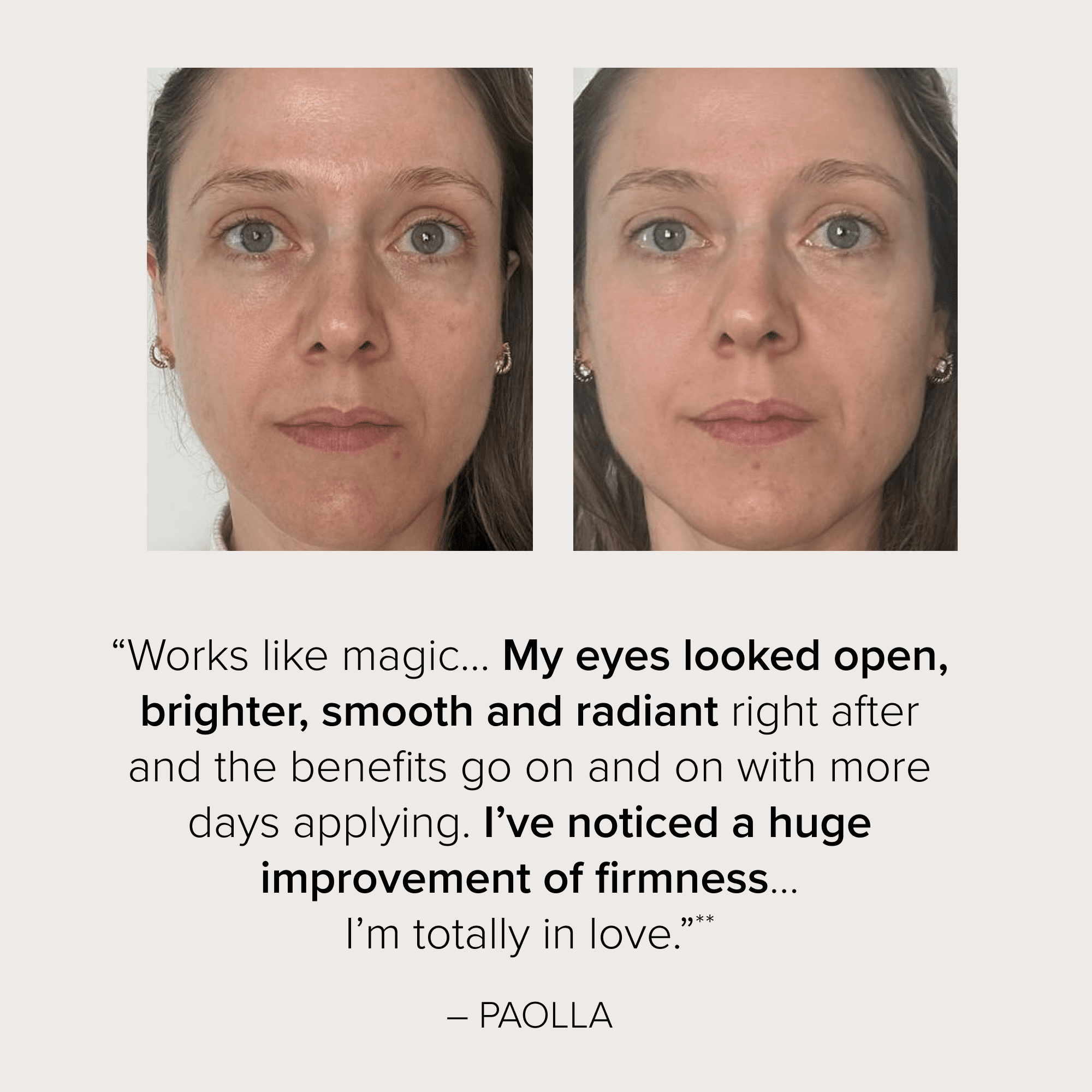 SeroVital Dark Circle Eraser - Hormone Aware Skincare - Visibly Tone, Smooth,  Boost Brightness Around the Eyes