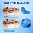 thumbnail image 5 of Under Eye Patches (30 Pairs) - Hyaluronic Acid Eye Masks for Dark Circles Puffy Eyes Undereye Bags - Undereye Brightening, Hydrating, Anti-Wrinkle & Cooling, Skin Care Gift for Her, 5 of 7