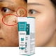 thumbnail image 1 of Crema blanqueadora para pecas, elimina el Melasma, elimina las manchas oscuras, el eliminador de melasma de melanina, ilumina la piel, antienvejecimiento. Afortunado Sencillez, 1 of 5