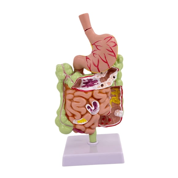 braveheart Stomach Anatomy Model Removerable Teaching Model Human Stomach Anatomy Digestive System Section Tool Full Color