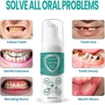 thumbnail image 4 of Teeth Mouthwash, Teethaid Mouthwash, Teeth Whitening Mousse Foam, Calculus Removal, Eliminating Bad Breath, Preventing-Healing Caries, 4 of 5