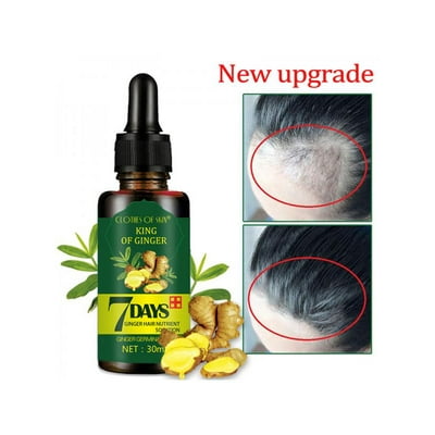 7 Day Ginger Germinal Serum Essence Oil Loss Treatement Growth Hair Regrow 30ml