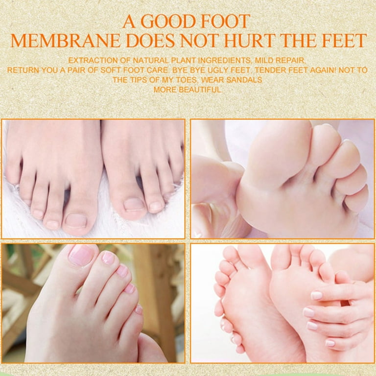 Exfoliating Feet Care Remove Dead Skin Cuticles Heel Pedicure - China  Pedicure and Exfoliating Foot Care Pedicure price