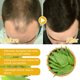 thumbnail image 4 of Puntoco Champú con biotina para el crecimiento del cabello, fortalece el cabello, previene la caída del cabello, champú bálsamo para el cabello, champú de ortiga, 30 g, 4 of 5