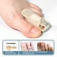 thumbnail image 3 of Corrector Ortopédico para Alisar el Dito en Martillo, Férula para el Dedo del Pie, Para Aliviar El Dedo en Martillo, Hombres y Mujeres adultos, 3 of 7