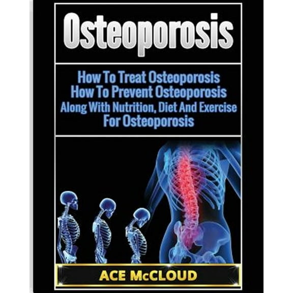 Pre-Owned Osteoporosis: How To Treat Osteoporosis: How To Prevent Osteoporosis: Along With Nutrition, Diet And Exercise For Osteoporosis