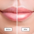 thumbnail image 4 of Bálsamo labial Grace & Stella Kiss Me Softly Berry, 20 ml (paquete de 3), 4 of 8
