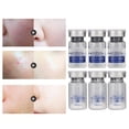 thumbnail image 1 of Freeze Freeze Dried Powder Repair Liquid Pimples Scar Removal Face Skin Care Serum, 1 of 8