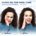 thumbnail image 2 of Aceite esencial HIQILI de clavo 100% puro y natural, 10 ml, para dientes, 2 of 8