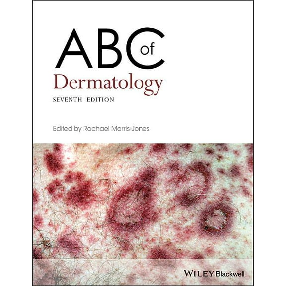 ABC: ABC of Dermatology (Paperback)