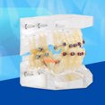 thumbnail image 1 of Tratamiento de Ortodoncia Dental de Maloclusión de Dientes Modelo con Cadena de Alambre Estudio Amonsee NO, 1 of 6