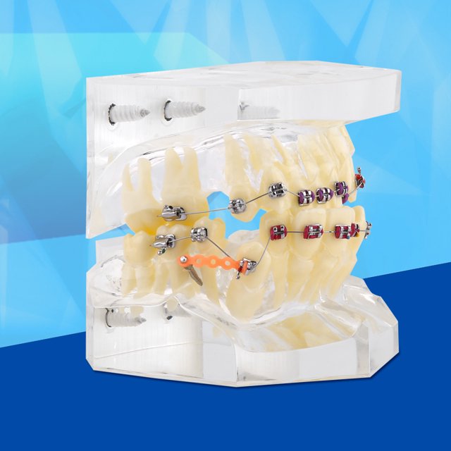 Tratamiento de Ortodoncia Dental de Maloclusión de Dientes Modelo con Cadena de Alambre Estudio Amonsee NO