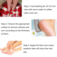 thumbnail image 5 of Foot File, Double Sided Cracked Heel Files Callus Remover, Stainless Steel Pedicure Foot Scrubber, 5 of 5