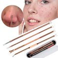 thumbnail image 2 of 4PCS Blackhead Remover Pimple Comedone Extractor Tool Acne Kit - Treatment for Blemish, Whitehead Popping, Zit Removing for Risk Free Nose Face Skin - Rose gold, 2 of 7