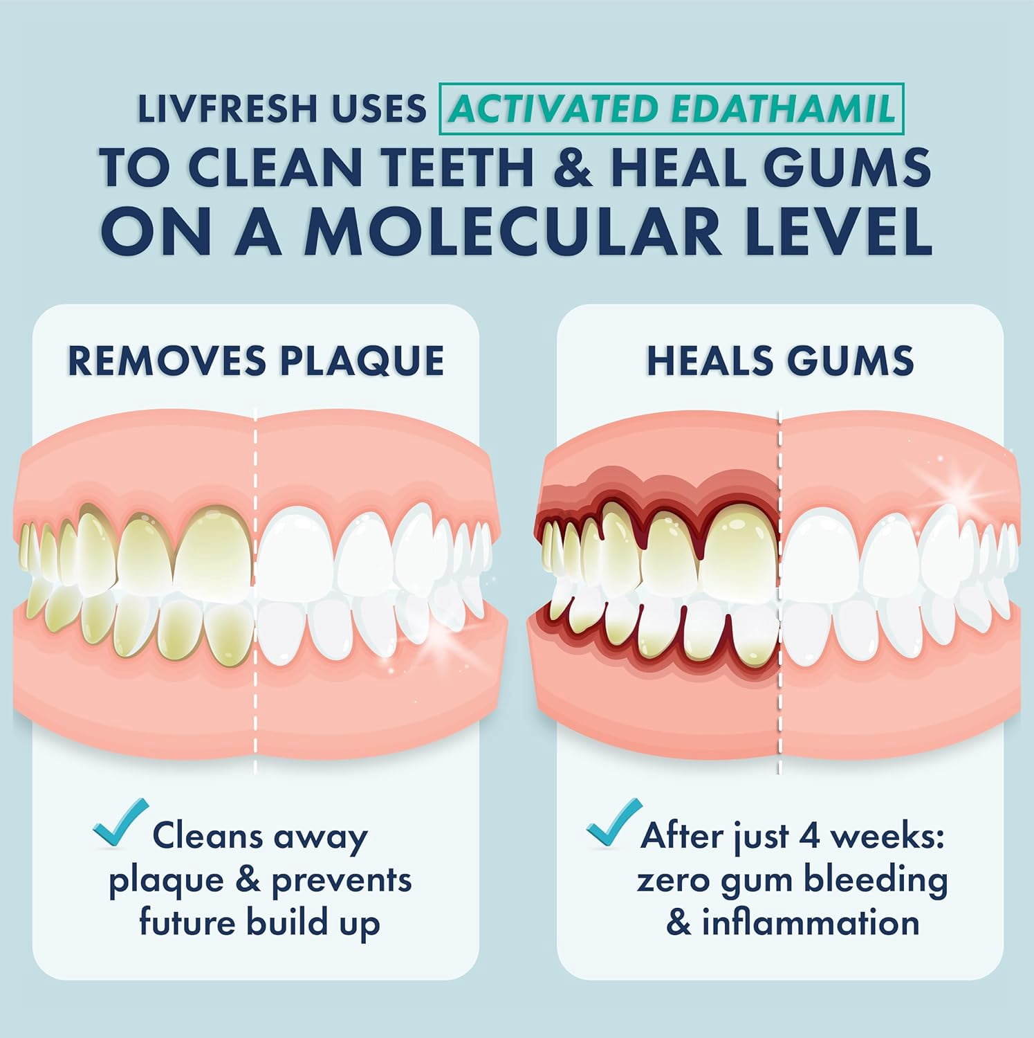 LIVFRESH Dental Gel by Livionex - Clinically Proven to Remove Plaque 250% Better (Peppermint + Non-Foaming + Blue Gel)