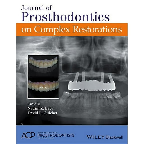 Journal of Prosthodontics on Complex Restorations (Hardcover)