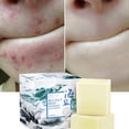 thumbnail image 2 of Limpiador de aceite para rostro CZ TRADE 100 g Jabón de leche de mar Cuidado facial, 2 of 7