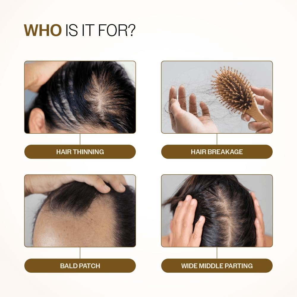 Bare Anatomy Advanced Hair Growth Serum| 3% Redensyl - 2x Better Results than Minoxidil | + 4% Anagain + 3% Baicapil | Rosemary, Biotin | Hair growth & Hair fall control serum for Women & Men | 30mL