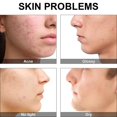thumbnail image 4 of Green Mask Stick, Green Tea Cleansing Mask Stick Limpieza profunda Control de aceite Blackhead Remover, Green Stick-Green tea- Sincero Electrónica, 4 of 5