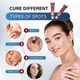 thumbnail image 2 of 1/2Pcs Skin Tag Removal Cream Moles Acne Scar Wart Treatment Remover Herbal Safe, 2 of 4