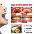 thumbnail image 4 of Baking Soda Toothpaste Teeth Whitening, Intensive Stain Removal Whitening Toothpaste, Teeth Whitening Toothpaste, Prevent Tooth Decay, Passion Fruit and Tooth Brush, 4 of 6