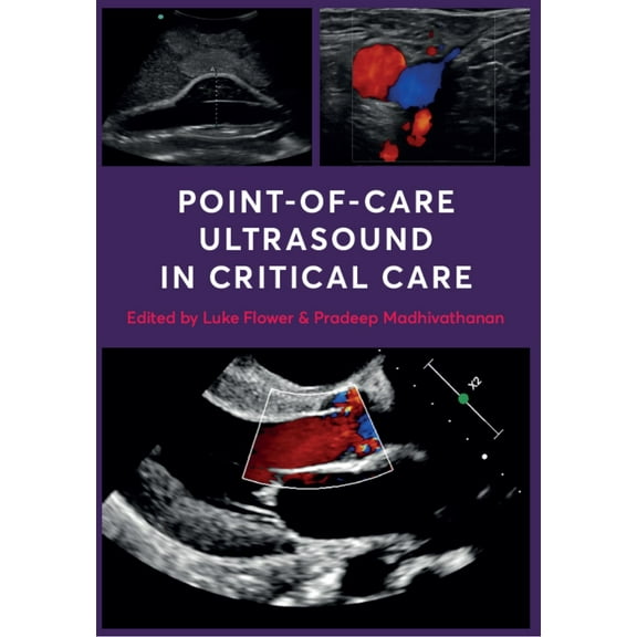 Point-of-Care Ultrasound in Critical Care (Paperback)