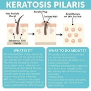 KP Bump Eraser Body Set Keratosis Pilaris Treatment Keratosis Pilaris Lotion | Exfoliating Body Scrub